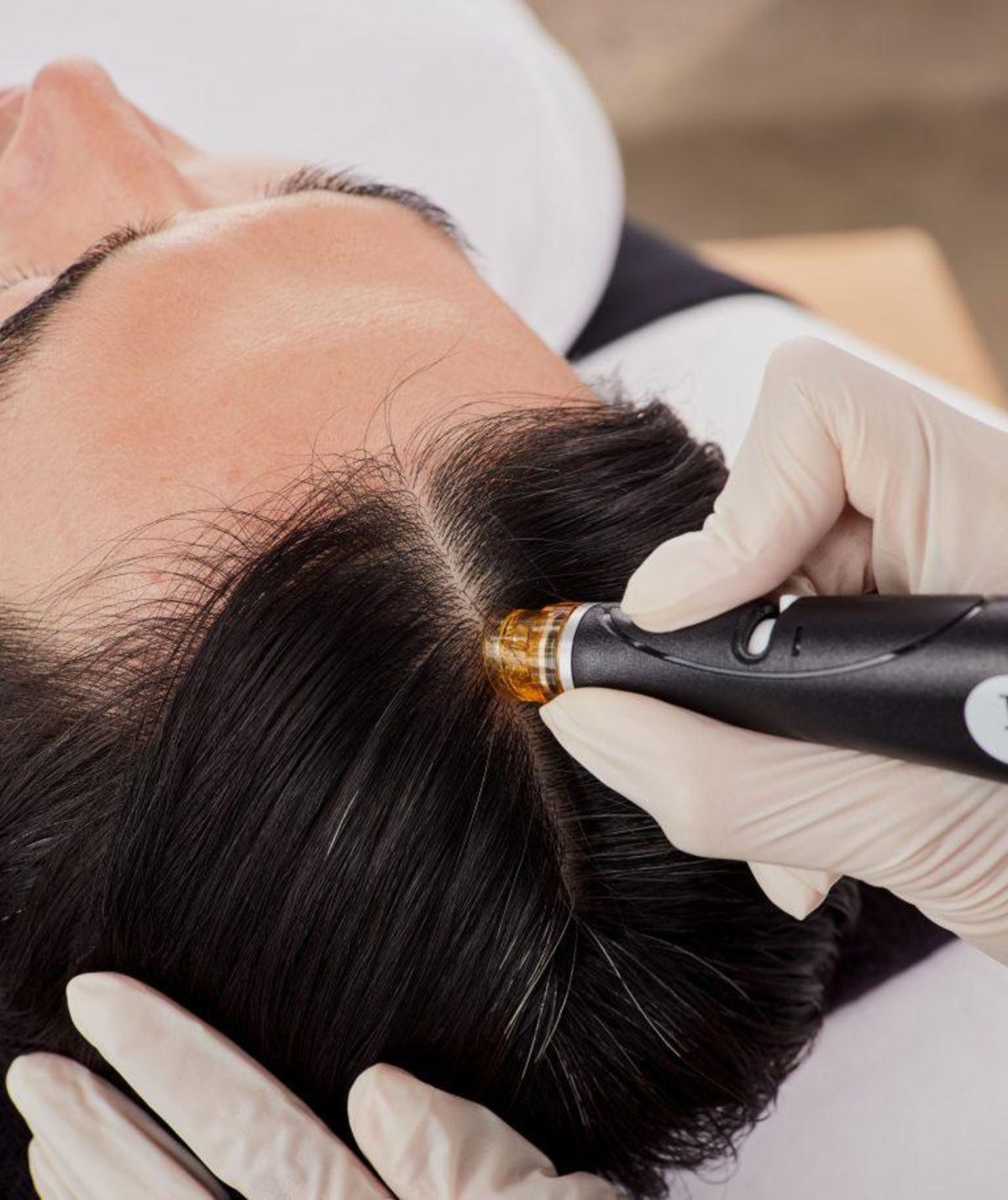 PRP hair restoration treatment at Beata Aesthetics & Wellness
