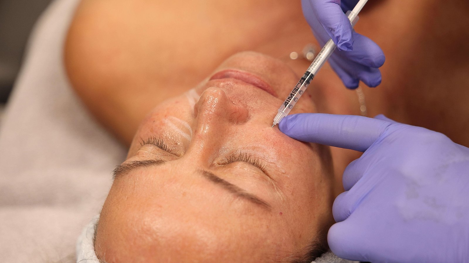 Injectable treatment at Beata Aesthetics & Wellness