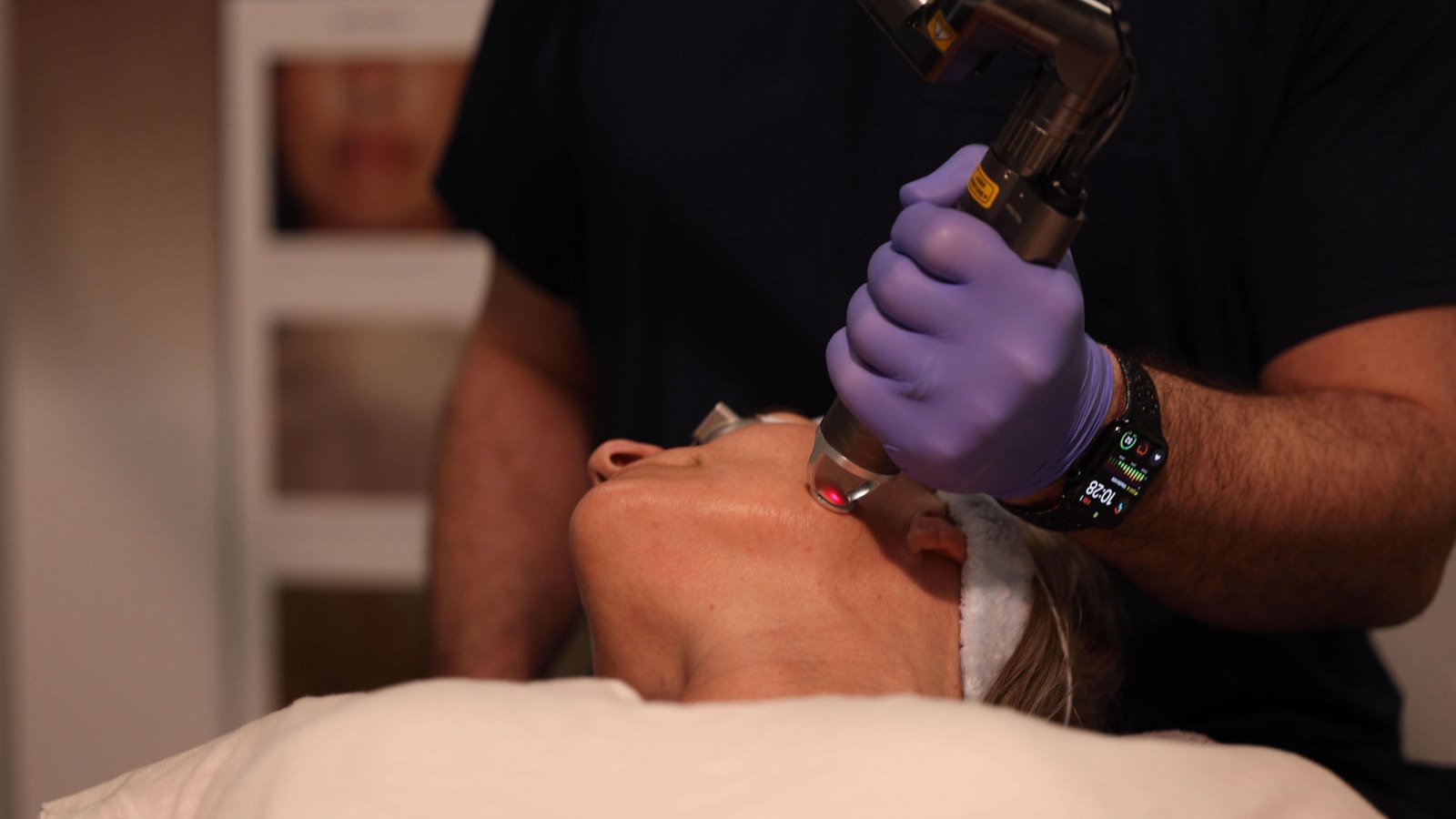 Laser skin treatment at Beata Aesthetics & Wellness