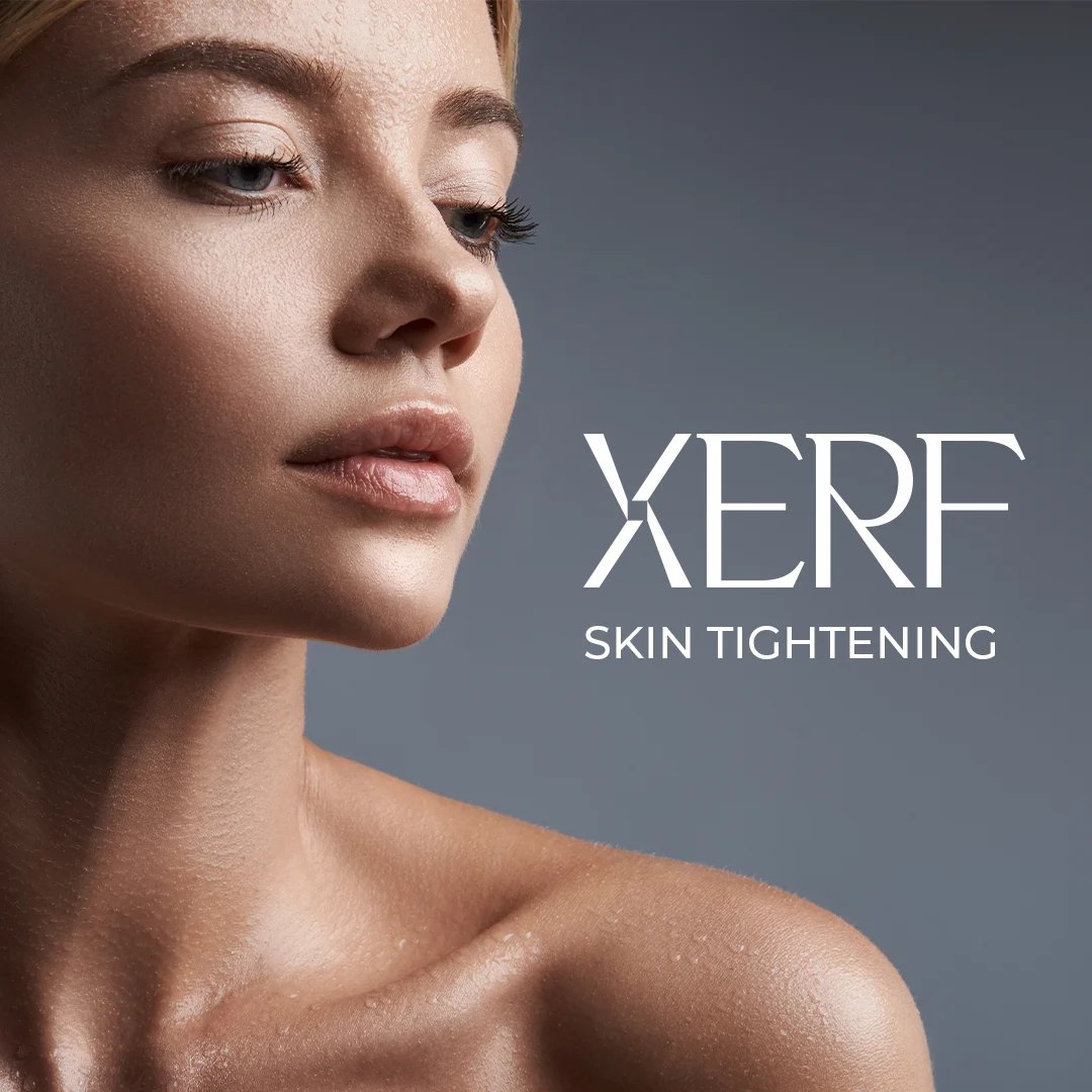 XERF non-surgical skin tightening at Beata Aesthetics & Wellness